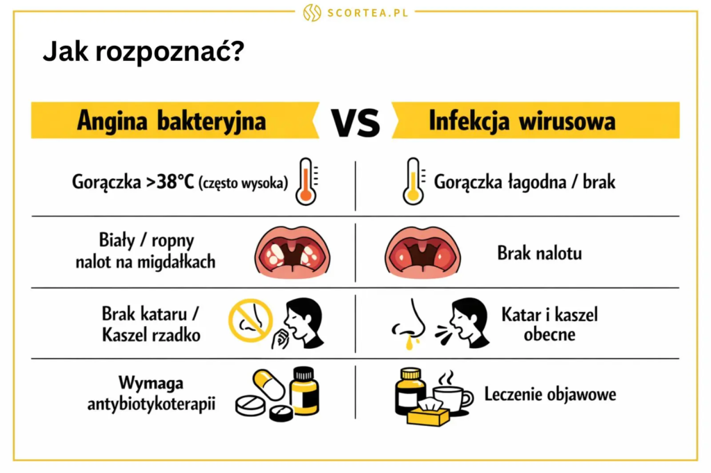 Tabela porównująca objawy anginy bakteryjnej i infekcji wirusowej, uwzględniająca gorączkę, nalot na migdałkach, kaszel oraz sposób leczenia.