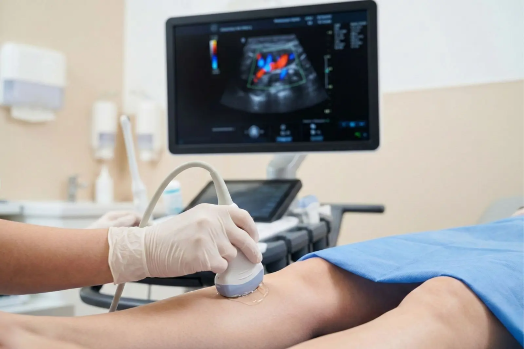 Lekarz w rękawiczkach przeprowadza badanie USG Doppler żył kończyny dolnej pacjenta, używając głowicy ultrasonograficznej z żelem na łydce. W tle, na monitorze aparatu USG, wyświetlany jest kolorowy obraz przepływu krwi.