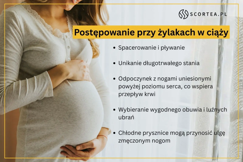 nfografika SCORTEA.PL zatytułowana "Postępowanie przy żylakach w ciąży", na której widoczna jest kobieta w ciąży oraz lista zaleceń: spacerowanie i pływanie, unikanie długotrwałego stania, odpoczynek z uniesionymi nogami, wybieranie wygodnego obuwia i luźnych ubrań oraz stosowanie chłodnych pryszniców dla ulgi zmęczonym nogom.