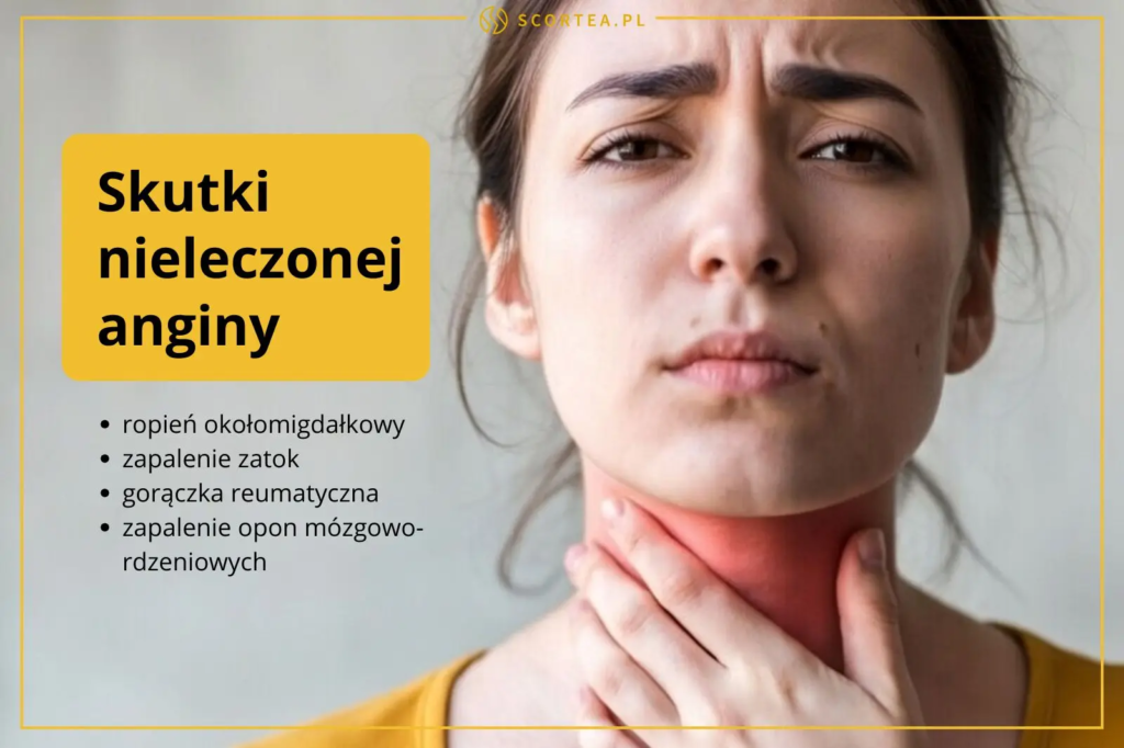 Kobieta trzymająca się za zaczerwienione gardło. Obok tekst: Skutki nieleczonej anginy, m.in. ropień, zapalenie zatok i gorączka reumatyczna.