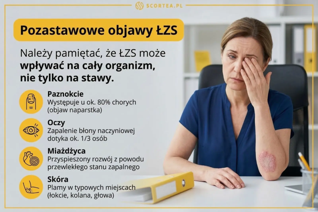 Infografika o pozastawowych objawach ŁZS. Wymienia wpływ na paznokcie, oczy, układ krwionośny oraz skórę. Na zdjęciu kobieta ze zmianami na łokciu.