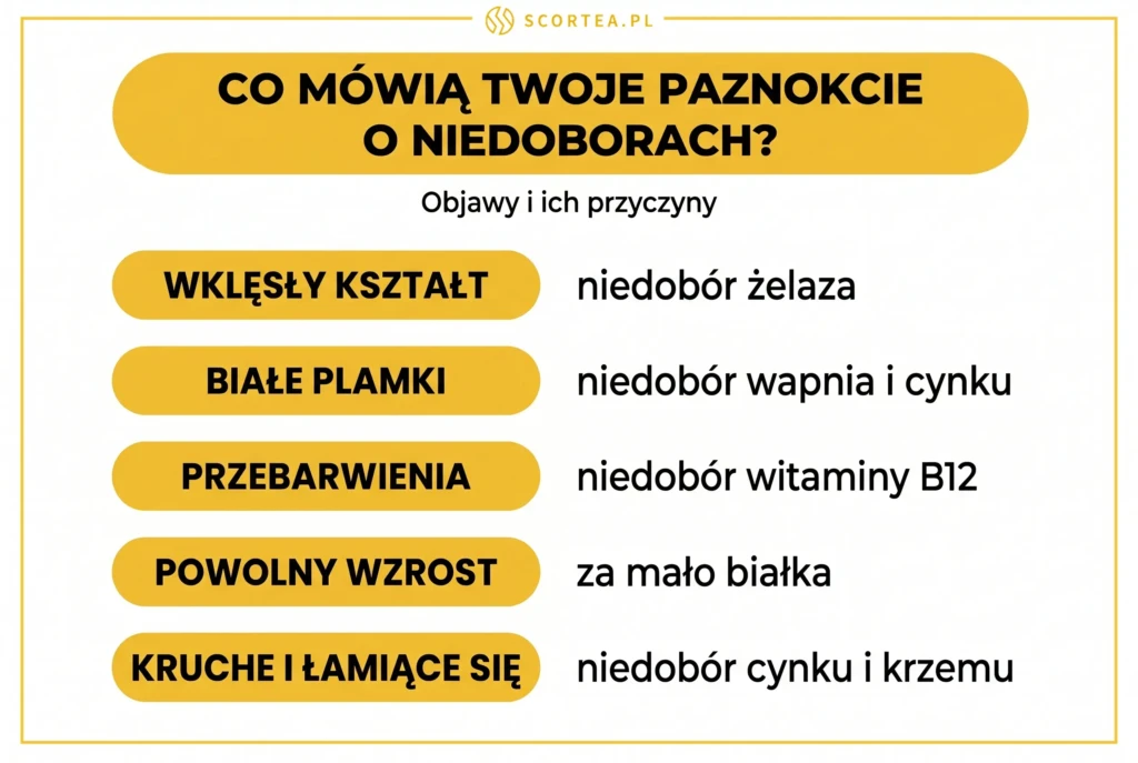 Infografika: co mówią twoje paznokcie o niedoborach - wklęsły kształt to niedobór żelaza, białe plamki to niedobór wapnia i cynku, przebarwienia to niedobór witaminy B12