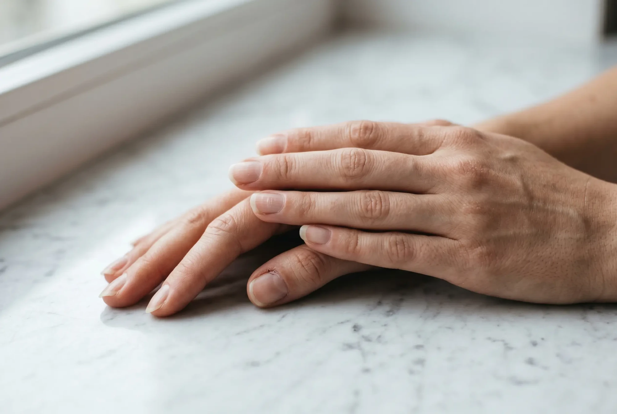 Kobiece dłonie z naturalnymi paznokciami wykazującymi pionowe bruzdy i matowość płytki, ułożone na białym marmurze