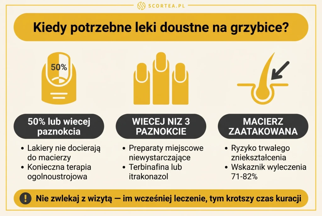 kiedy potrzebne leki doustne na grzybicę — przy zajęciu 50% paznokcia, ponad 3 paznokciach lub zajęciu macierzy paznokcia