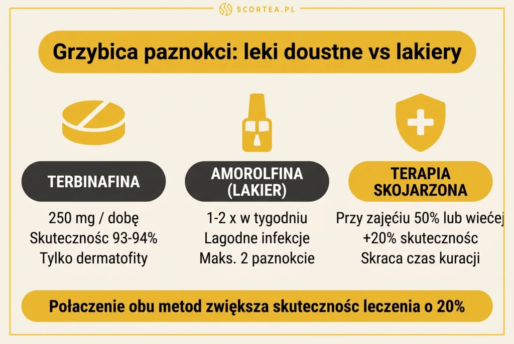 Infografika: 4 kroki leczenia grzybicy paznokci — badanie mikologiczne, lakier leczniczy, terbinafina 250 mg i profilaktyka nawrotu