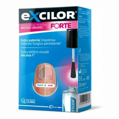 Excilor Forte Extra Mocny Lakier Leczenie Grzybicy Paznokci 30ml