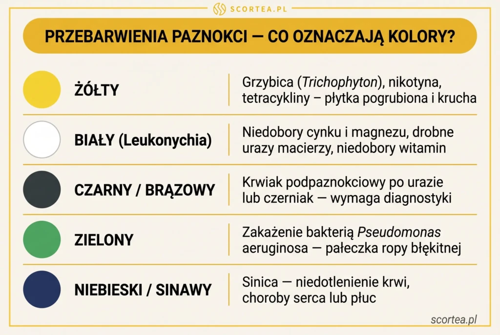 Tabela przebarwień paznokci: żółty (grzybica), biały (leukonychia), czarny, zielony i niebieski z medycznymi przyczynami