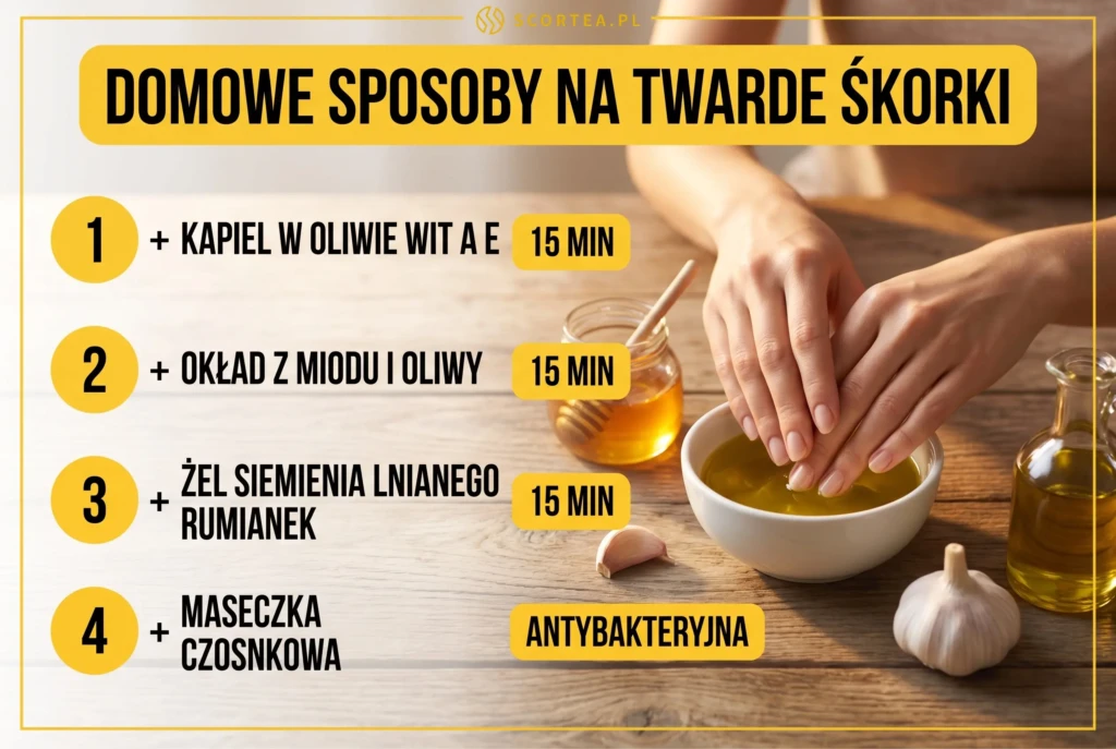  Infografika — 4 domowe sposoby na twarde skórki paznokci: kąpiel w oliwie z wit. A i E, okład z miodu i oliwy, żel z siemienia lnianego z rumiankiem, maseczka czosnkowa.