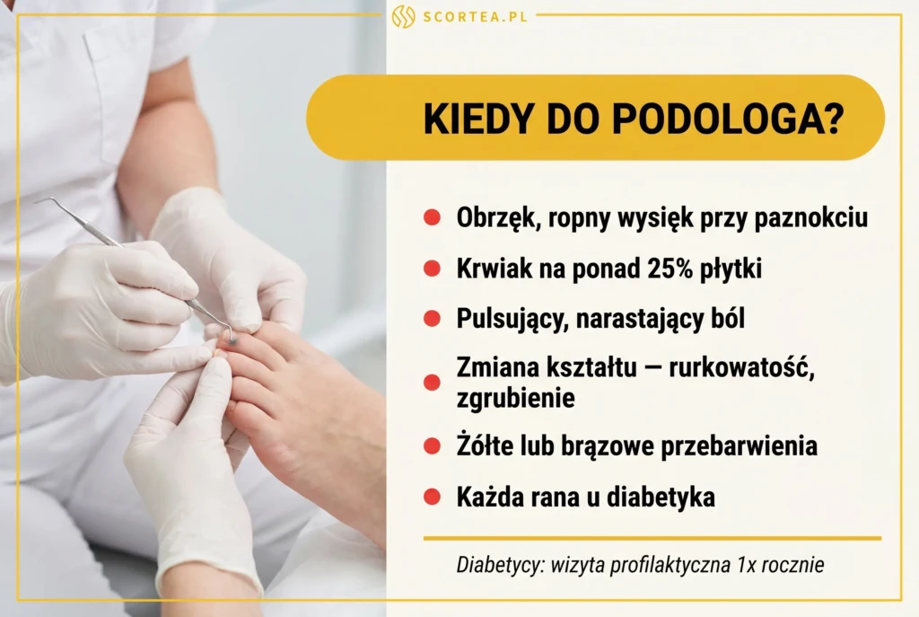 Infografika kiedy pilnie iść do podologa – 6 sygnałów alarmowych: obrzęk i ropny wysięk przy paznokciu, krwiak powyżej 25% płytki, pulsujący narastający ból, zmiana kształtu (rurkowatość, zgrubienie), żółte lub brązowe przebarwienia, każda rana u diabetyka


