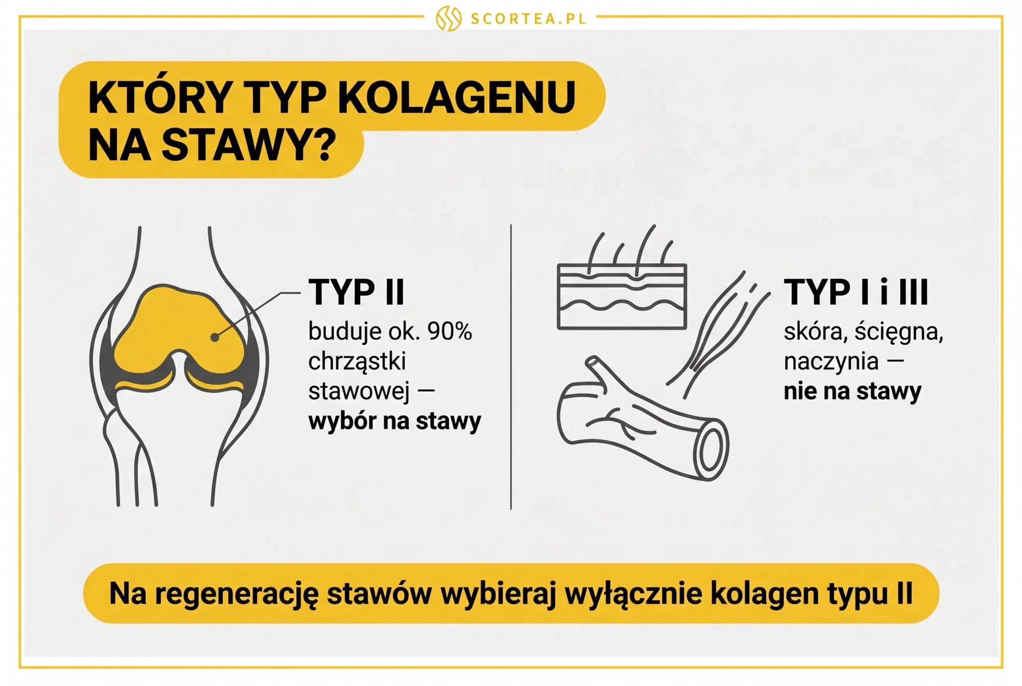 Infografika porównująca kolagen typu II budujący chrząstkę stawową z typem I i III odpowiedzialnym za skórę, ścięgna i naczynia