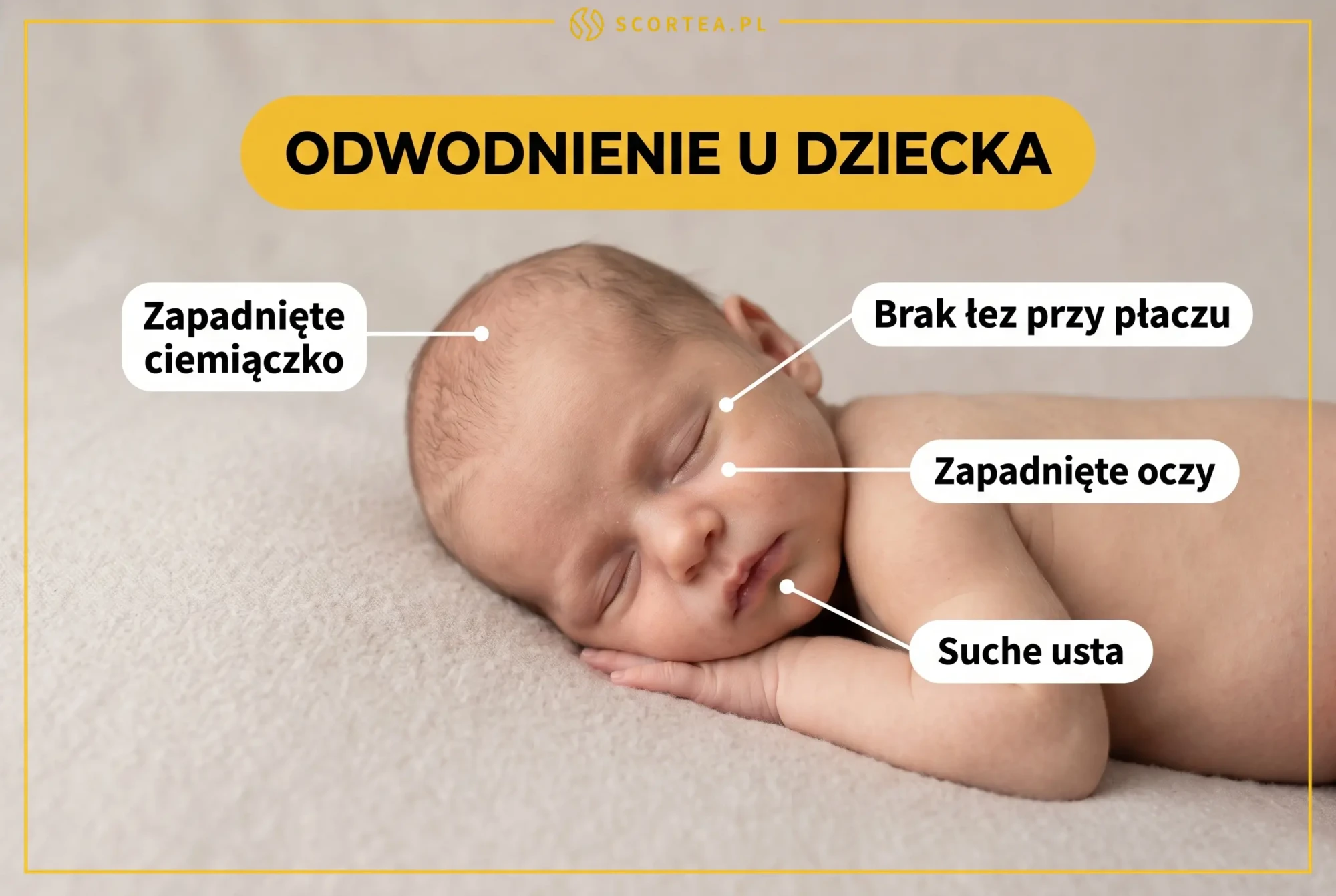 Infografika Scortea: objawy odwodnienia u dziecka - śpiące niemowlę z opisem zapadniętego ciemiączka, braku łez przy płaczu, zapadniętych oczu i suchych ust