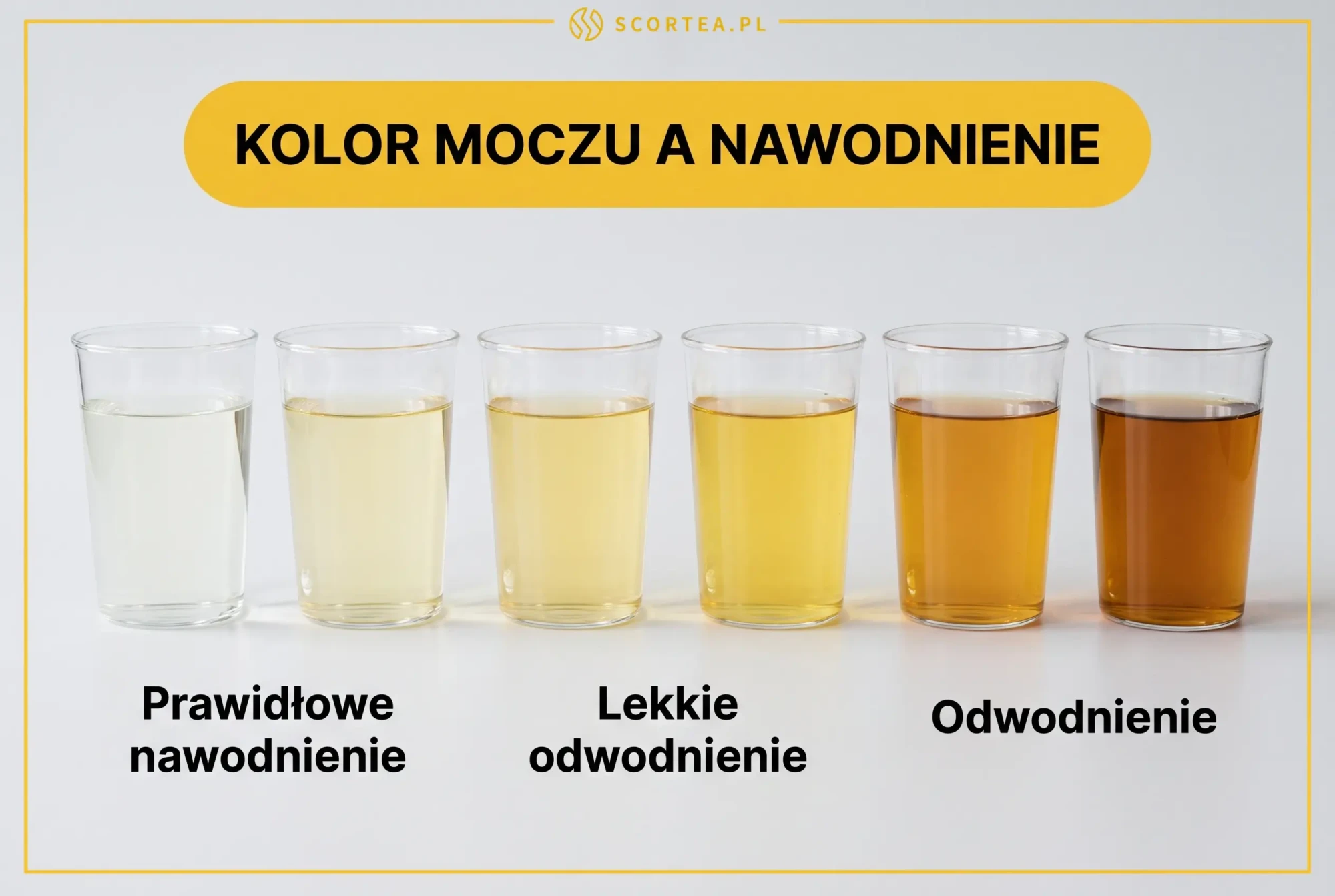 Infografika Scortea: skala koloru moczu a nawodnienie - sześć szklanek od jasnosłomkowego do ciemnobursztynowego z opisem prawidłowego nawodnienia i odwodnienia