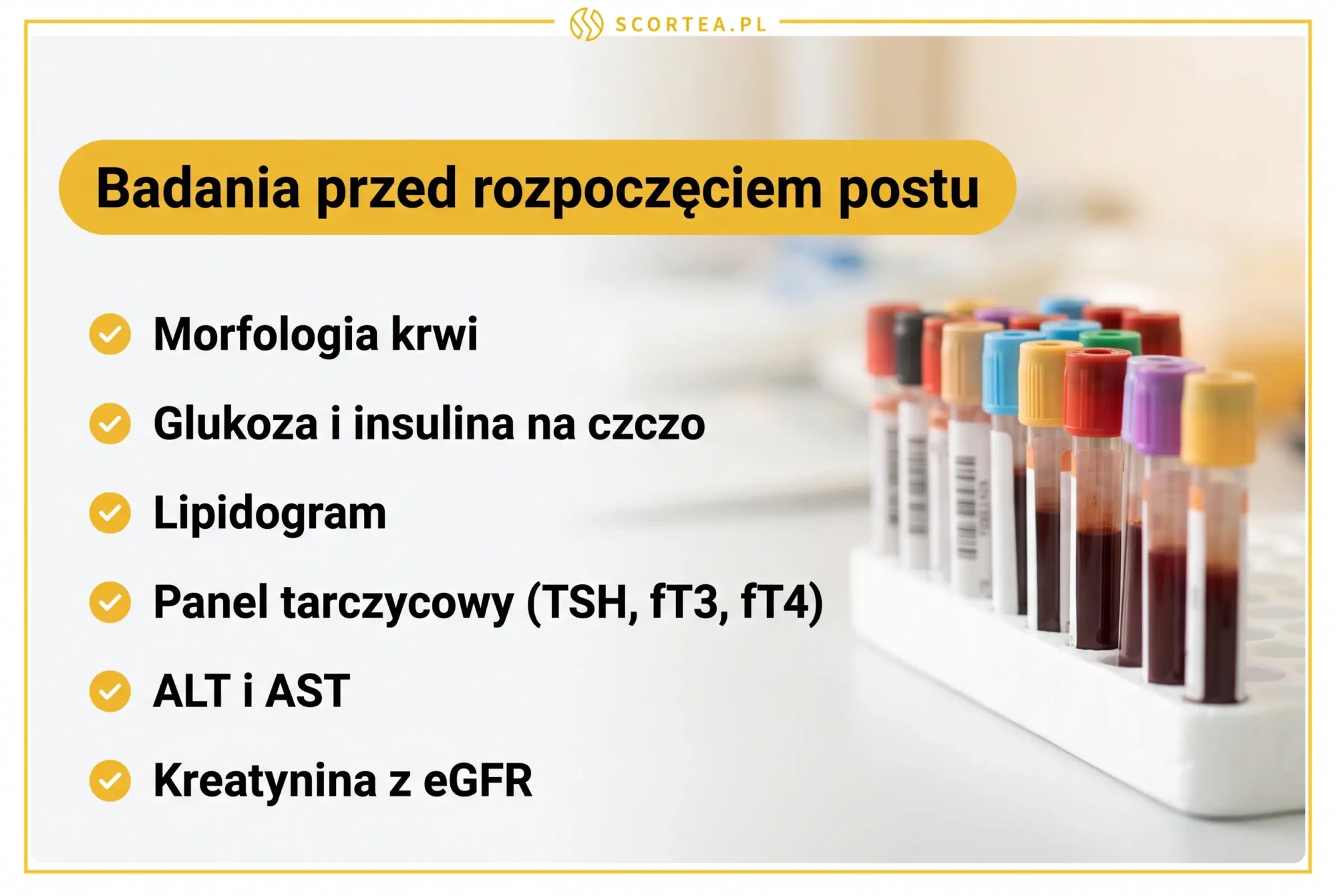 Infografika: badania krwi przed rozpoczęciem postu przerywanego - morfologia krwi, glukoza i insulina na czczo, lipidogram, panel tarczycowy TSH fT3 fT4, ALT i AST oraz kreatynina z eGFR