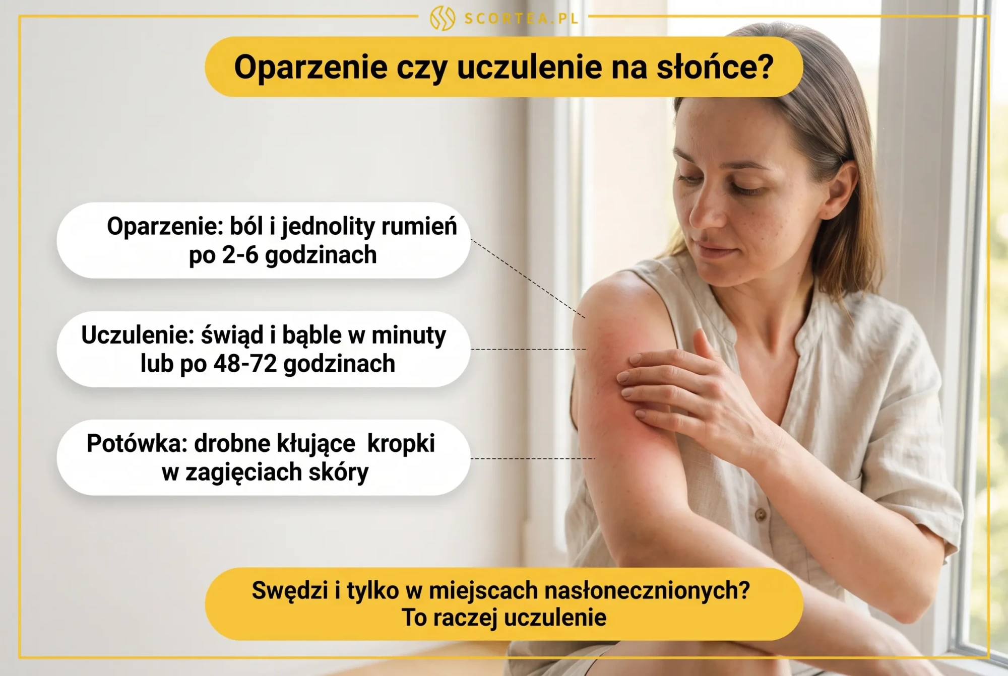 Infografika porównująca oparzenie słoneczne, uczulenie na słońce i potówkę według objawów oraz czasu pojawienia się zmian skórnych.