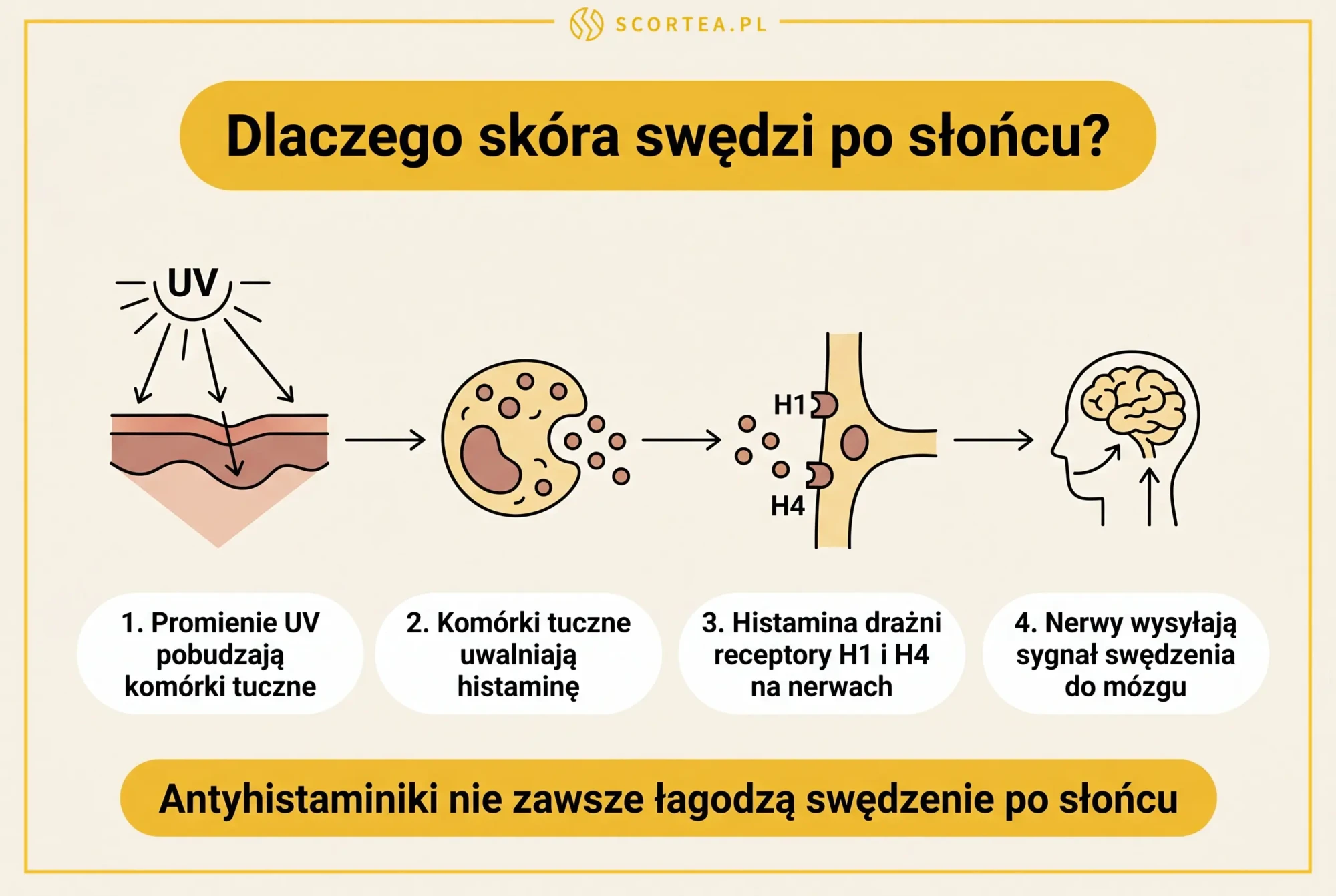 Infografika wyjaśniająca mechanizm świądu po słońcu: promienie UV pobudzają komórki tuczne, które uwalniają histaminę drażniącą receptory H1 i H4 na nerwach.