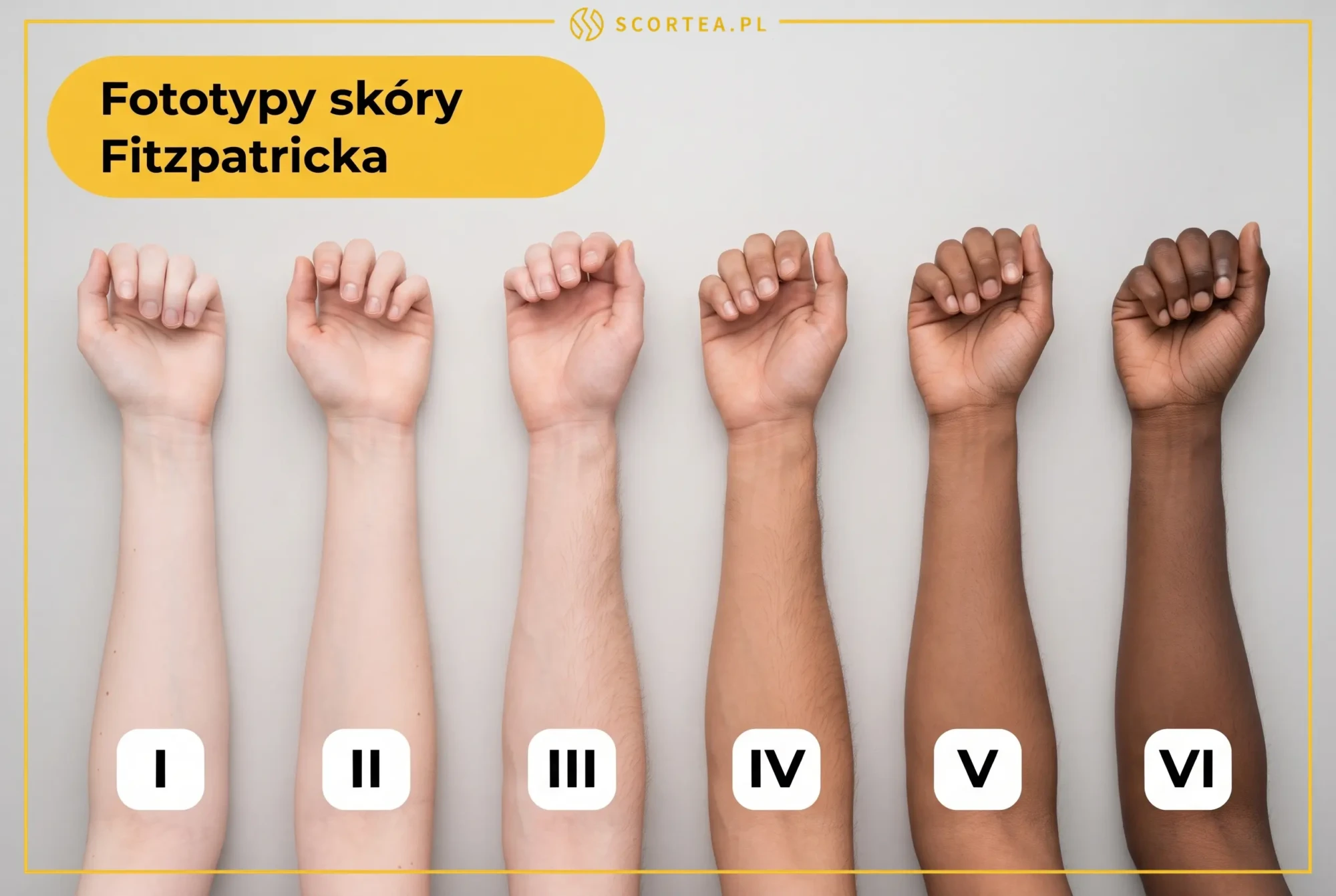 Sześć przedramion ułożonych od najjaśniejszej do najciemniejszej karnacji z oznaczeniami fototypów od I do VI według skali Fitzpatricka