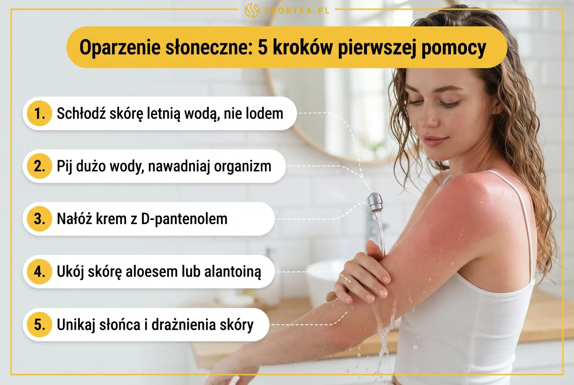 Infografika: 5 kroków pierwszej pomocy przy oparzeniu słonecznym, od schłodzenia skóry po nałożenie D-pantenolu