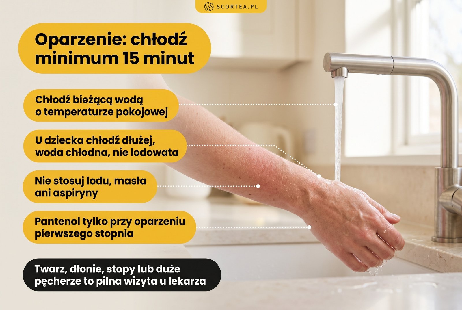 Infografika: pierwsza pomoc przy oparzeniu, chłodzenie bieżącą wodą przez minimum 15 minut, bez lodu, masła i aspiryny