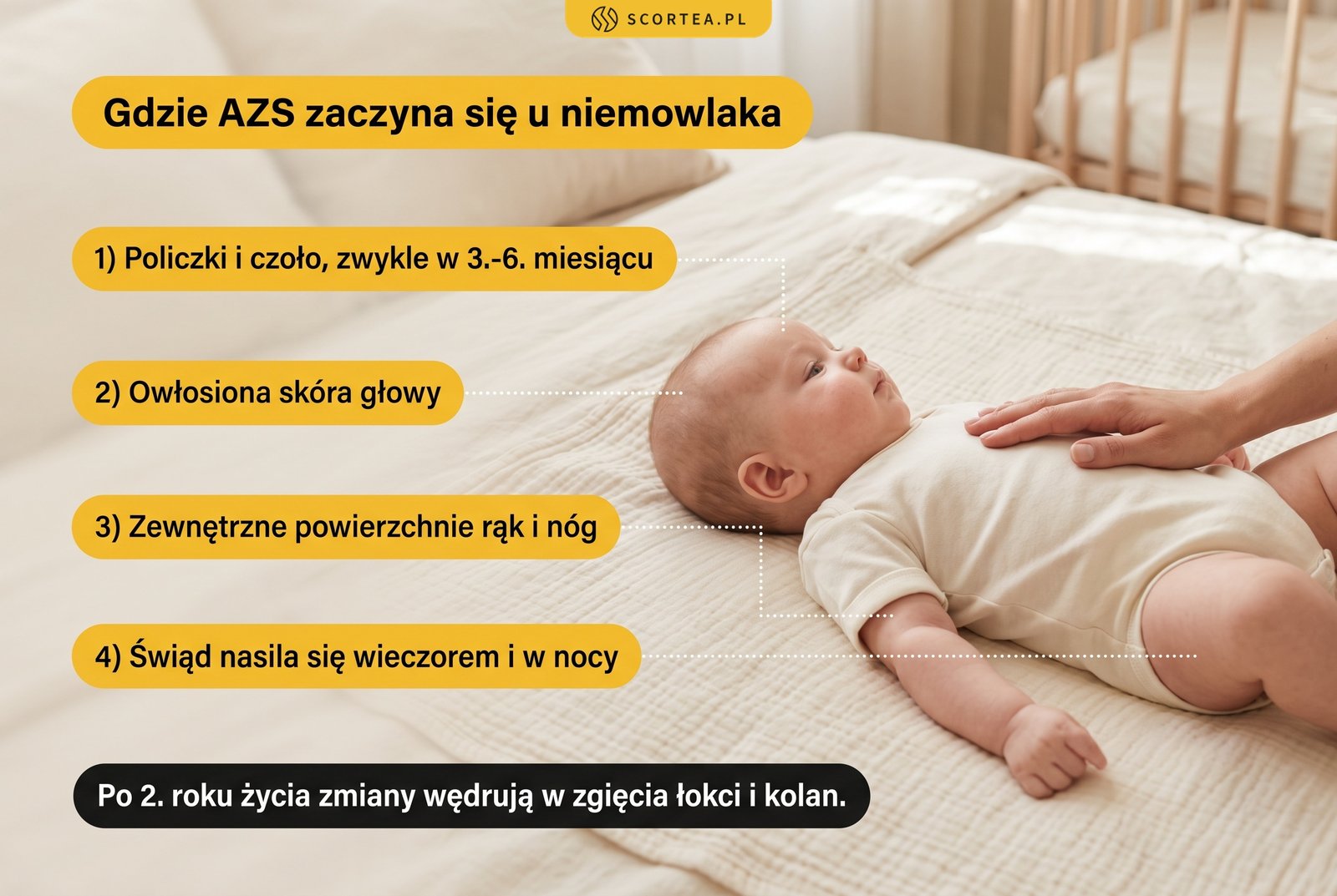 Infografika: miejsca pierwszych zmian AZS u niemowlaka, policzki, czoło, owłosiona skóra głowy oraz zewnętrzne powierzchnie rąk i nóg