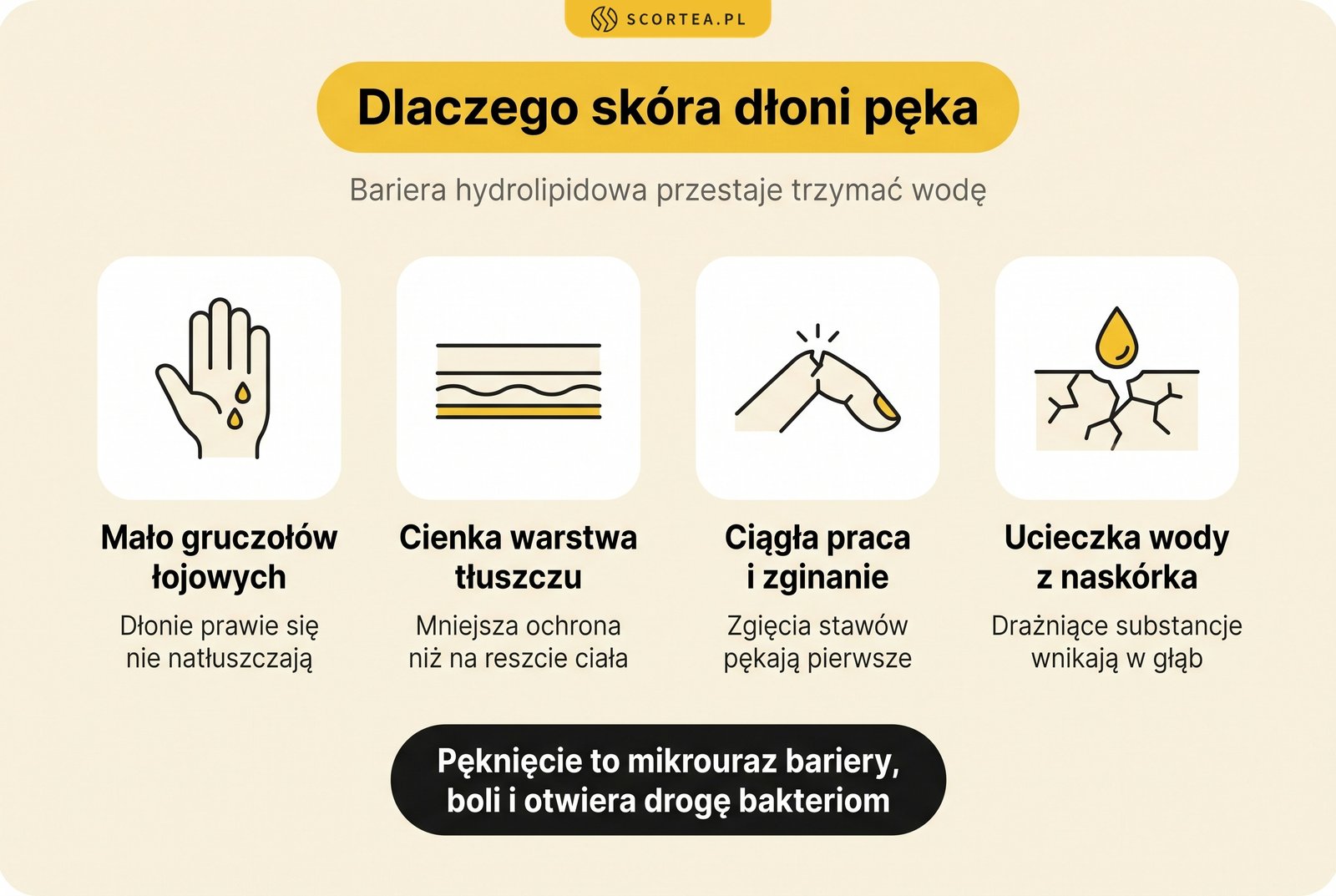 Infografika: cztery powody, dla których skóra dłoni pęka, od braku gruczołów łojowych po ucieczkę wody z naskórka
