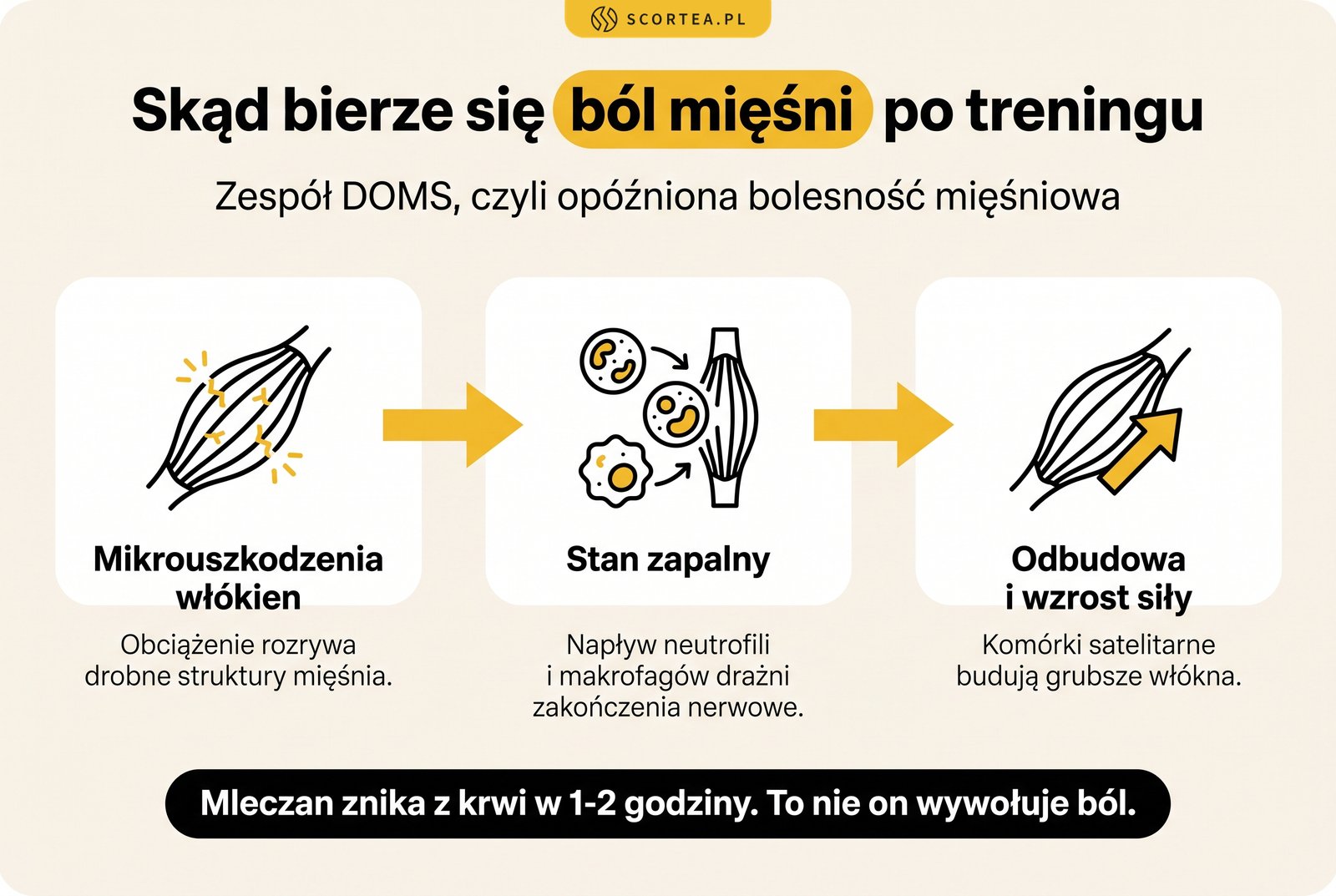 Schemat mechanizmu DOMS: mikrouszkodzenia włókien mięśniowych, stan zapalny i odbudowa mięśnia po treningu