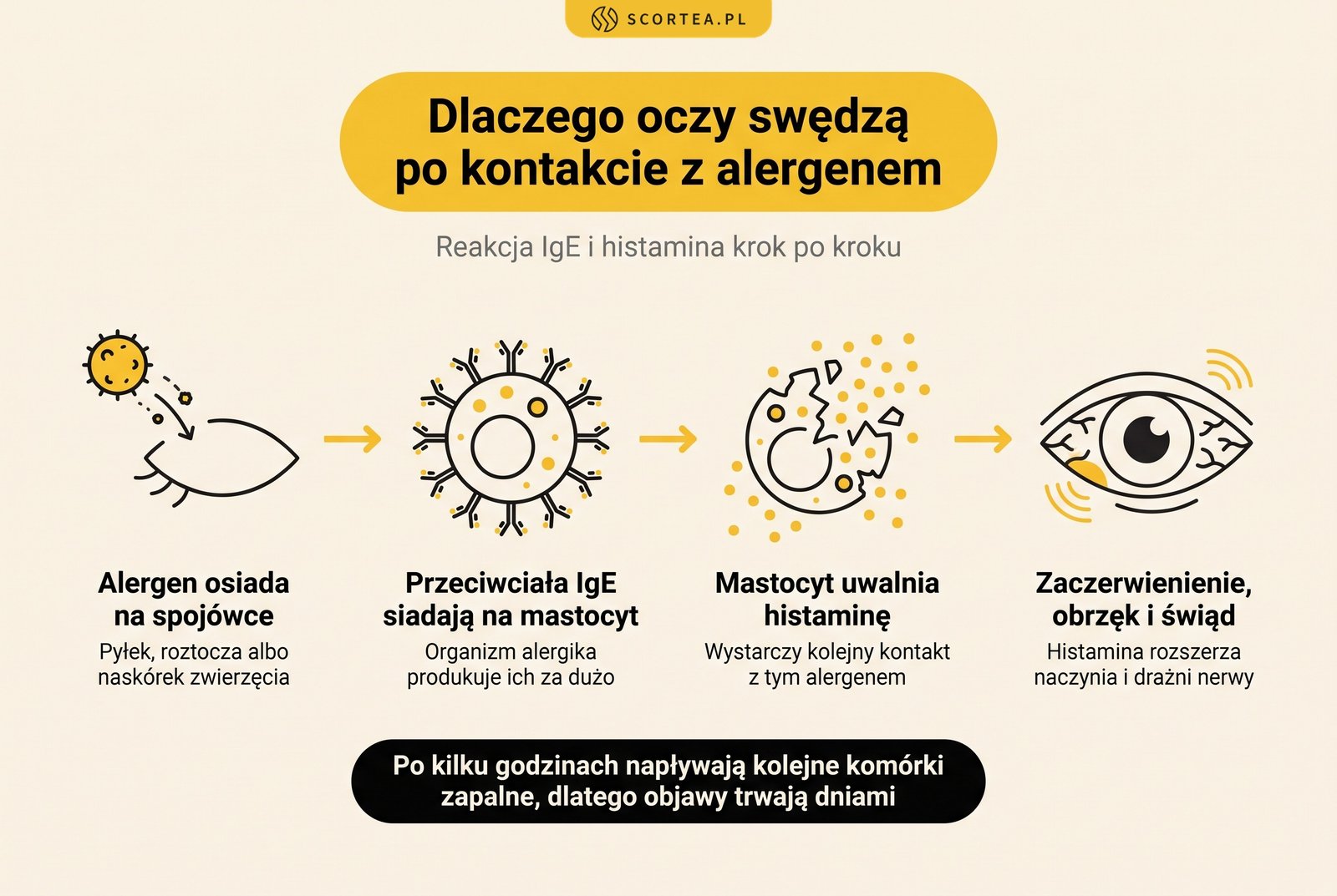 Infografika: mechanizm reakcji alergicznej w oku - alergen osiada na spojówce, przeciwciała IgE wiążą się z mastocytem, komórka tuczna uwalnia histaminę, powstaje zaczerwienienie, obrzęk i świąd