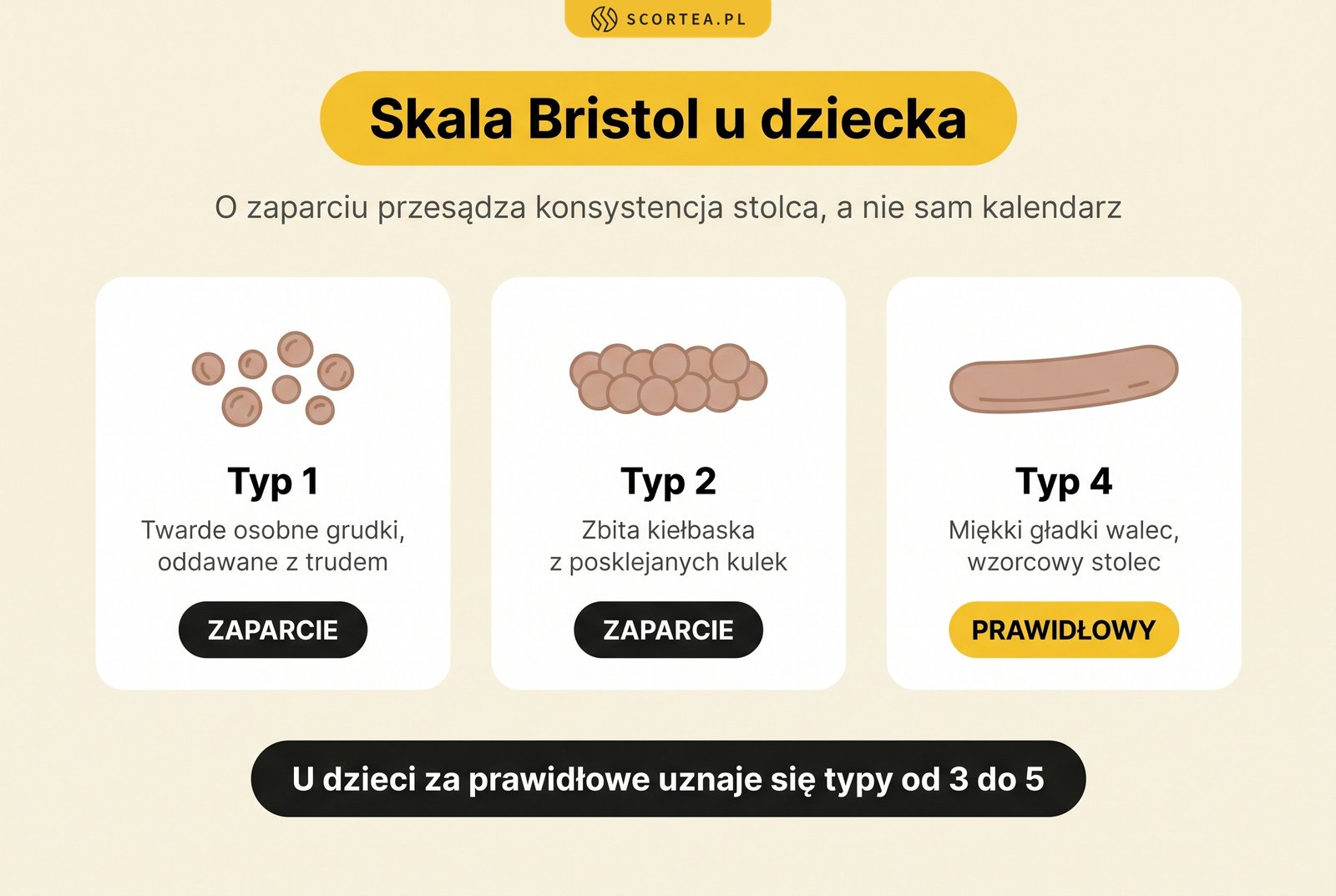 Skala Bristol u dziecka: typ 1 i typ 2 oznaczają zaparcie, typ 4 to prawidłowy miękki stolec